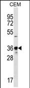Phosducin antibody, PA5-71702, Invitrogen Antibodies, Western Blot image 