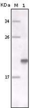 MER Proto-Oncogene, Tyrosine Kinase antibody, 32-192, ProSci, Western Blot image 