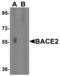 Beta-secretase 2 antibody, 2249, QED Bioscience, Western Blot image 