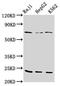 Proteasome Subunit Beta 9 antibody, CSB-PA018887LA01HU, Cusabio, Western Blot image 