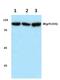 Insulin Receptor antibody, PA5-36738, Invitrogen Antibodies, Western Blot image 