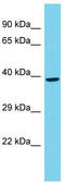 RNA Polymerase II Subunit C antibody, TA344650, Origene, Western Blot image 