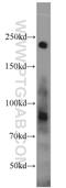 Sperm-specific antigen 2 antibody, 14157-1-AP, Proteintech Group, Western Blot image 