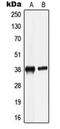 Leucine Rich Alpha-2-Glycoprotein 1 antibody, orb215353, Biorbyt, Western Blot image 