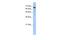 Rho GTPase Activating Protein 28 antibody, PA5-69972, Invitrogen Antibodies, Western Blot image 