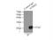 Stathmin 2 antibody, 10586-1-AP, Proteintech Group, Immunoprecipitation image 