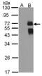 ST6 Beta-Galactoside Alpha-2,6-Sialyltransferase 1 antibody, PA5-27982, Invitrogen Antibodies, Western Blot image 