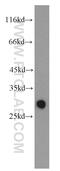 Glutathione S-Transferase Mu 3 antibody, 15214-1-AP, Proteintech Group, Western Blot image 