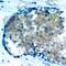 Ezrin antibody, AP0349, ABclonal Technology, Immunohistochemistry paraffin image 