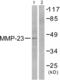 Matrix Metallopeptidase 23B antibody, abx013148, Abbexa, Western Blot image 