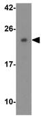 Claudin 4 antibody, GTX31496, GeneTex, Western Blot image 