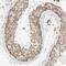 Sperm-associated antigen 5 antibody, NBP1-85261, Novus Biologicals, Immunohistochemistry paraffin image 
