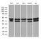 GA Binding Protein Transcription Factor Subunit Beta 1 antibody, M07070, Boster Biological Technology, Western Blot image 