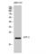Activating Transcription Factor 3 antibody, LS-C382181, Lifespan Biosciences, Western Blot image 