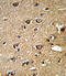 Peptidylprolyl Isomerase A antibody, LS-C163898, Lifespan Biosciences, Immunohistochemistry paraffin image 