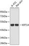 Keratin 14 antibody, 19-221, ProSci, Western Blot image 