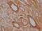 TRAP antibody, CSB-RA786226A0HU, Cusabio, Immunohistochemistry paraffin image 