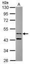 Sorting Nexin 15 antibody, NBP2-20442, Novus Biologicals, Western Blot image 