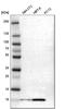S100 Calcium Binding Protein A6 antibody, HPA007575, Atlas Antibodies, Western Blot image 