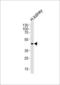 Carboxypeptidase M antibody, LS-B13763, Lifespan Biosciences, Western Blot image 