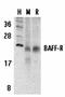 TNF Receptor Superfamily Member 13C antibody, orb74491, Biorbyt, Western Blot image 