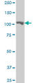 Methionyl-TRNA Synthetase antibody, LS-C197652, Lifespan Biosciences, Western Blot image 