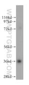 Sideroflexin 3 antibody, 15156-1-AP, Proteintech Group, Western Blot image 