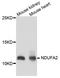 NADH:Ubiquinone Oxidoreductase Subunit A2 antibody, A8136, ABclonal Technology, Western Blot image 