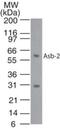 Ankyrin Repeat And SOCS Box Containing 2 antibody, GTX13710, GeneTex, Western Blot image 