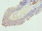 RAD50 Interactor 1 antibody, LS-C395381, Lifespan Biosciences, Immunohistochemistry paraffin image 