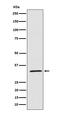 Mitochondrial brown fat uncoupling protein 1 antibody, M00255, Boster Biological Technology, Western Blot image 