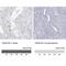 Testis Specific Serine Kinase 1B antibody, NBP1-83883, Novus Biologicals, Immunohistochemistry paraffin image 