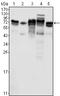 Metadherin antibody, STJ98256, St John