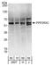 Protein Phosphatase 2 Regulatory Subunit B'Gamma antibody, A303-814A, Bethyl Labs, Western Blot image 