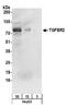 Transforming Growth Factor Beta Receptor 2 antibody, A304-414A, Bethyl Labs, Western Blot image 