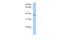 Acyl-CoA Dehydrogenase Short/Branched Chain antibody, A08652, Boster Biological Technology, Western Blot image 