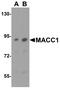 MET Transcriptional Regulator MACC1 antibody, A04732, Boster Biological Technology, Western Blot image 