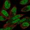 Pleckstrin Homology Domain Interacting Protein antibody, HPA019838, Atlas Antibodies, Immunofluorescence image 