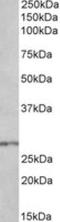 Homeobox B9 antibody, NBP2-27467, Novus Biologicals, Western Blot image 