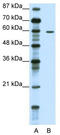 Tripartite Motif Containing 62 antibody, TA345243, Origene, Western Blot image 
