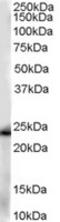 Glutathione S-transferase P 1 antibody, TA302504, Origene, Western Blot image 