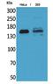 Protein Tyrosine Phosphatase Receptor Type J antibody, STJ96765, St John