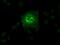 Solute Carrier Family 2 Member 6 antibody, MA5-24979, Invitrogen Antibodies, Immunocytochemistry image 