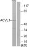 Activin A Receptor Like Type 1 antibody, LS-B6587, Lifespan Biosciences, Western Blot image 