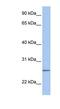 Ubiquitin Conjugating Enzyme E2 C antibody, NBP1-58166, Novus Biologicals, Western Blot image 