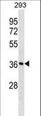 Survival Of Motor Neuron 2, Centromeric antibody, LS-C159042, Lifespan Biosciences, Western Blot image 