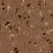 AKT Serine/Threonine Kinase 3 antibody, HPA026441, Atlas Antibodies, Immunohistochemistry frozen image 