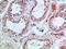Phosphoinositide-3-Kinase Regulatory Subunit 2 antibody, STJ98987, St John