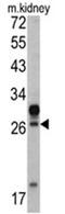 Homeobox A5 antibody, AP17479PU-N, Origene, Western Blot image 