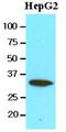 Carbonyl Reductase 3 antibody, LS-B3589, Lifespan Biosciences, Western Blot image 